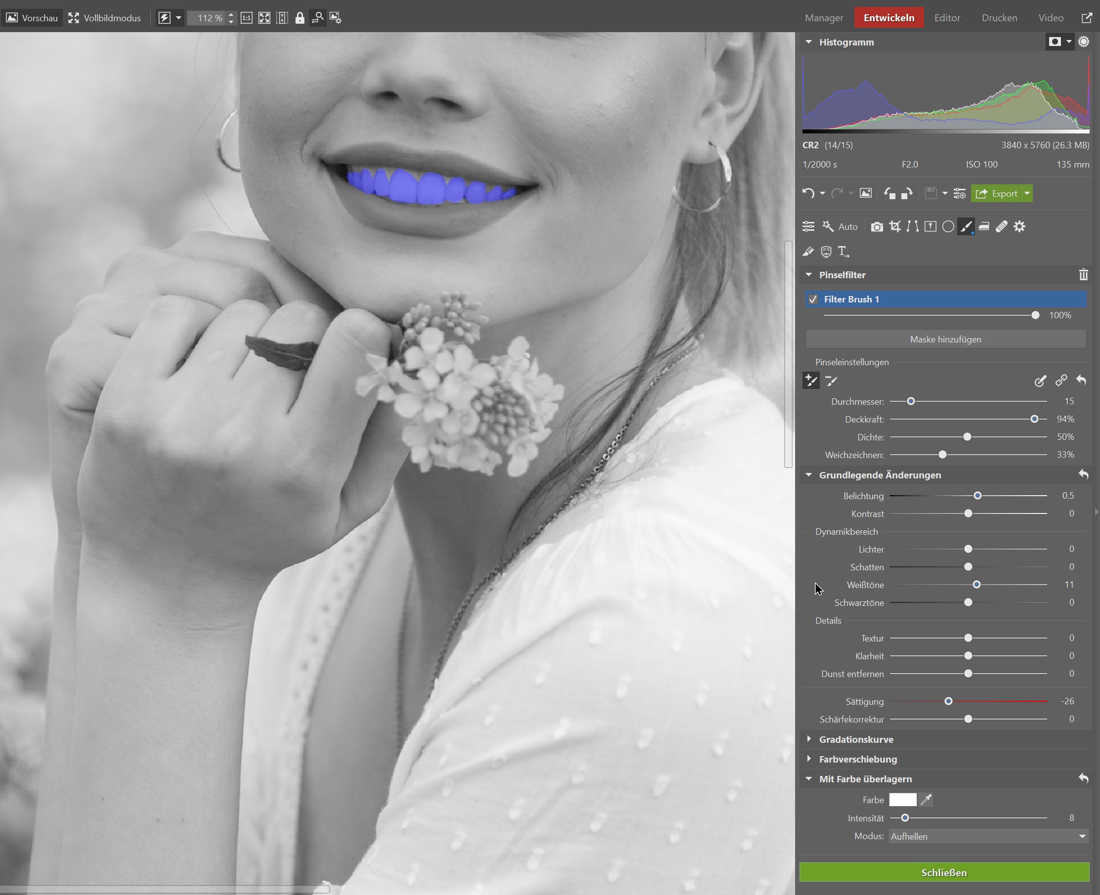 3 schnelle Tipps zum Aufhellen der Zähne