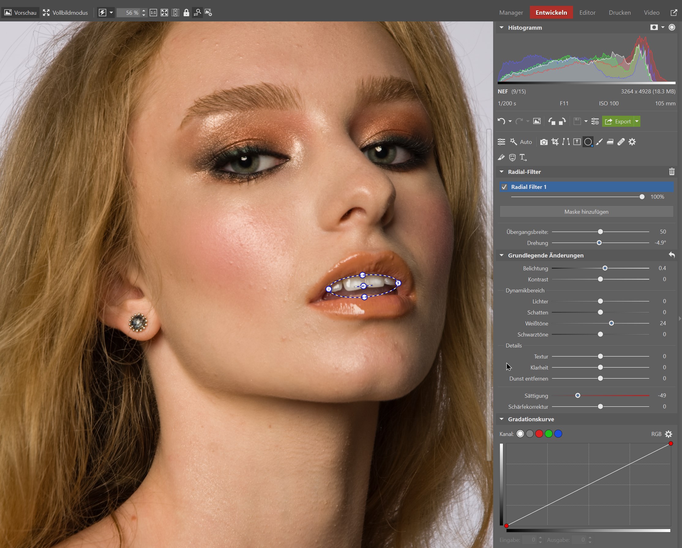 3 schnelle Tipps zum Aufhellen der Zähne
